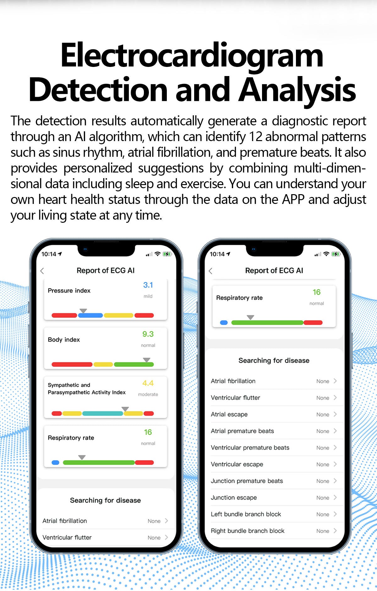 Smart ring monitors sleep quality, AI analyzes data for personalized health advice